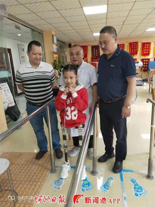 高位截肢健康指导建议,高位截肢健康指导建议有哪些。 健康建议 高位截肢健康指导建议,高位截肢健康指导建议有哪些。 高位截肢健康指导建议,高位截肢健康指导建议有哪些。 健康建议